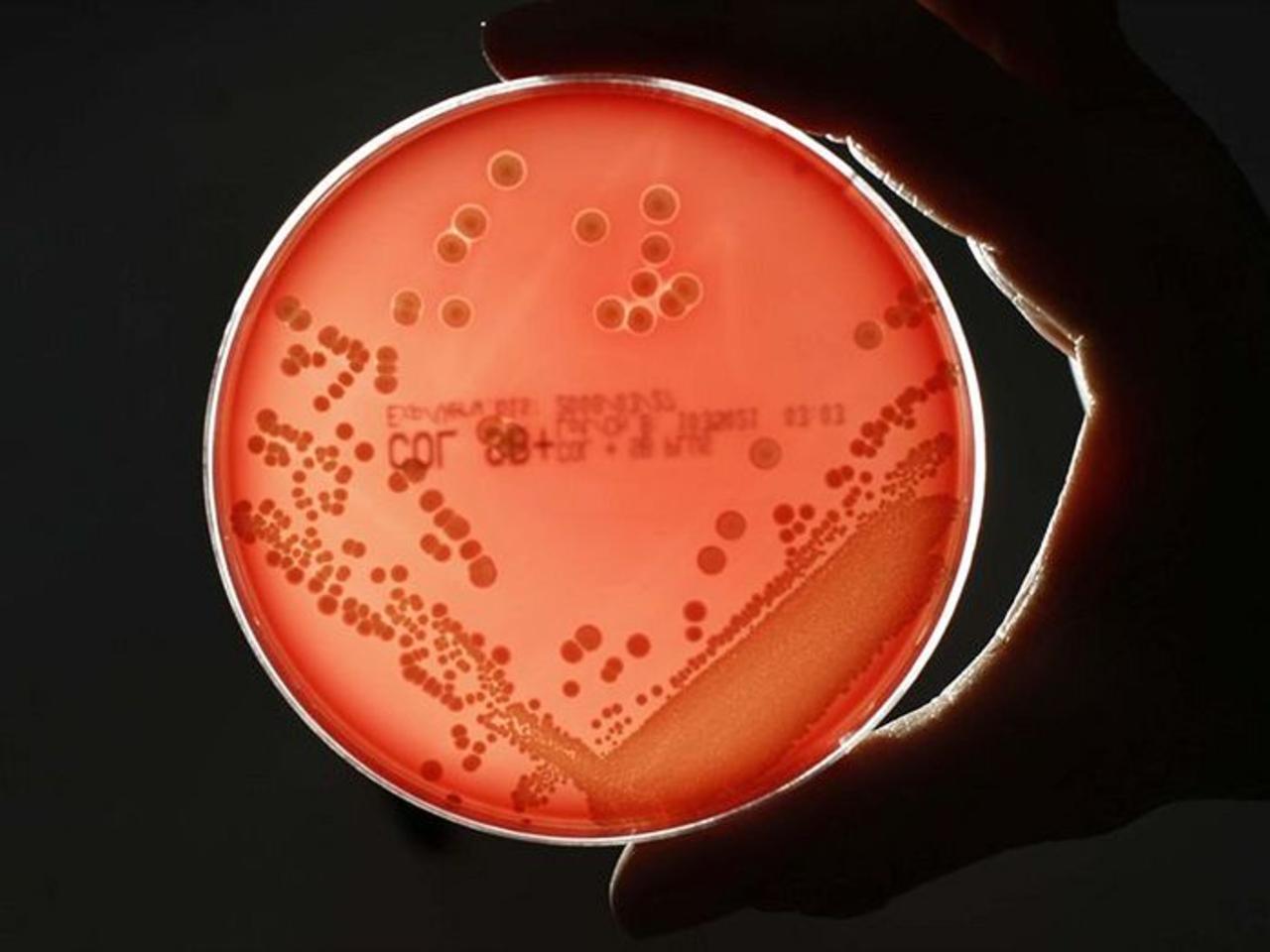 The rise and rise of the Superbug
